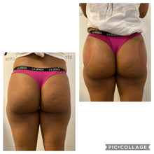 Load image into Gallery viewer, 6 x Colombian Butt Lift
